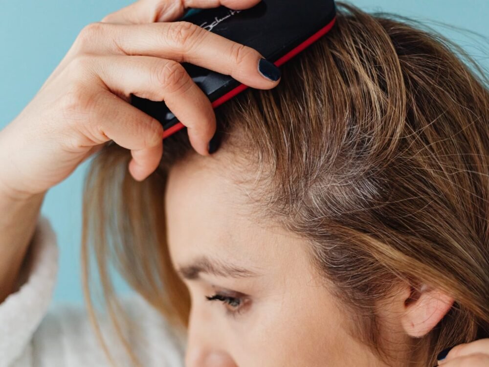 What to Know Before Choosing Itchy Scalp Relief